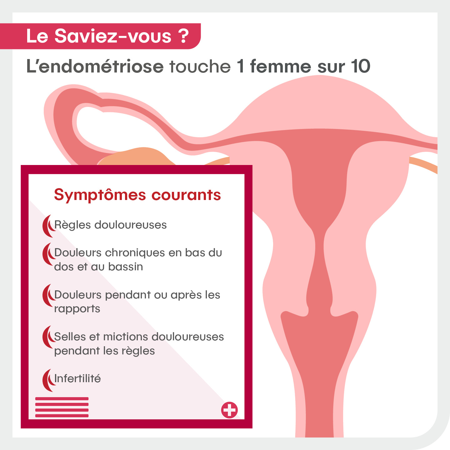 Les symptômes courants de l'endométriose