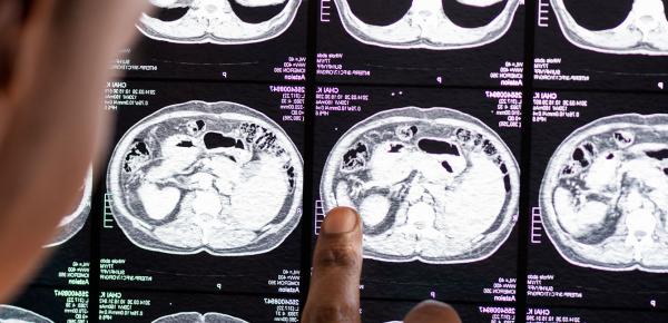 Le sport protège nos fonctions cérébrales