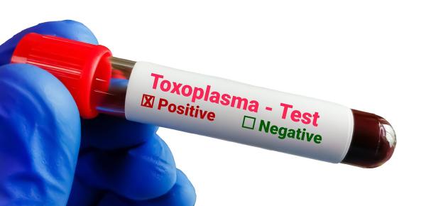 Qu’est-ce que la toxoplasmose ?