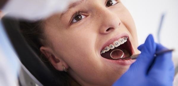 Orthodontie : les étapes du traitement et leur impact sur la confiance en soi