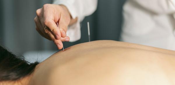 Acupuncture soulagez vos douleurs et améliorez votre bien-être