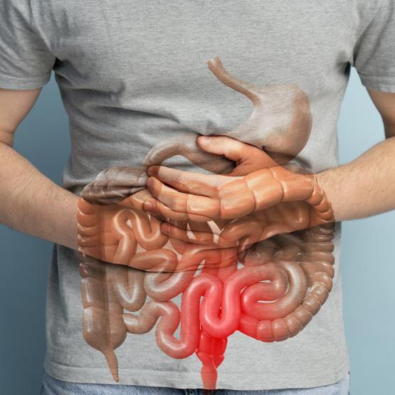 Cancer colorectal ou cancer de l’intestin