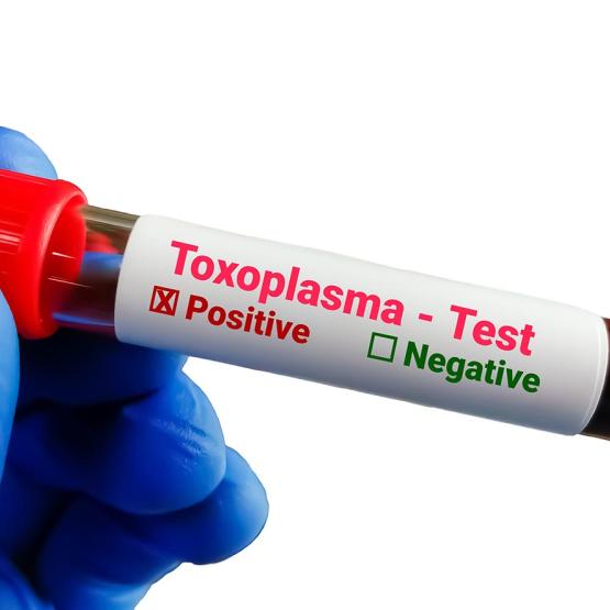 Qu’est-ce que la toxoplasmose ?
