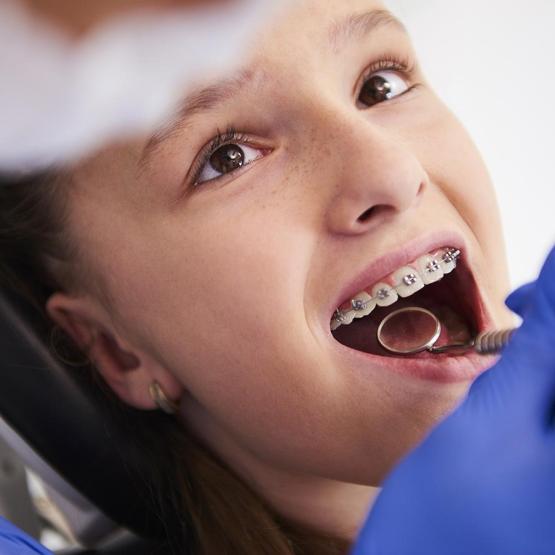 Orthodontie : les étapes du traitement et leur impact sur la confiance en soi