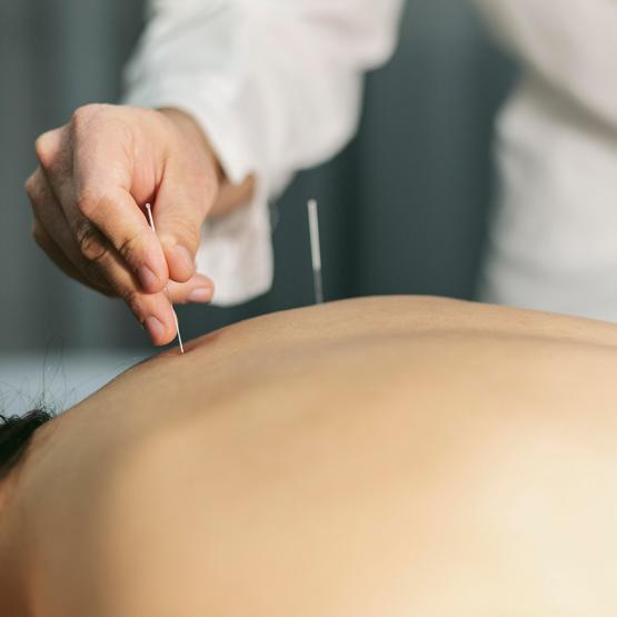 Acupuncture soulagez vos douleurs et améliorez votre bien-être
